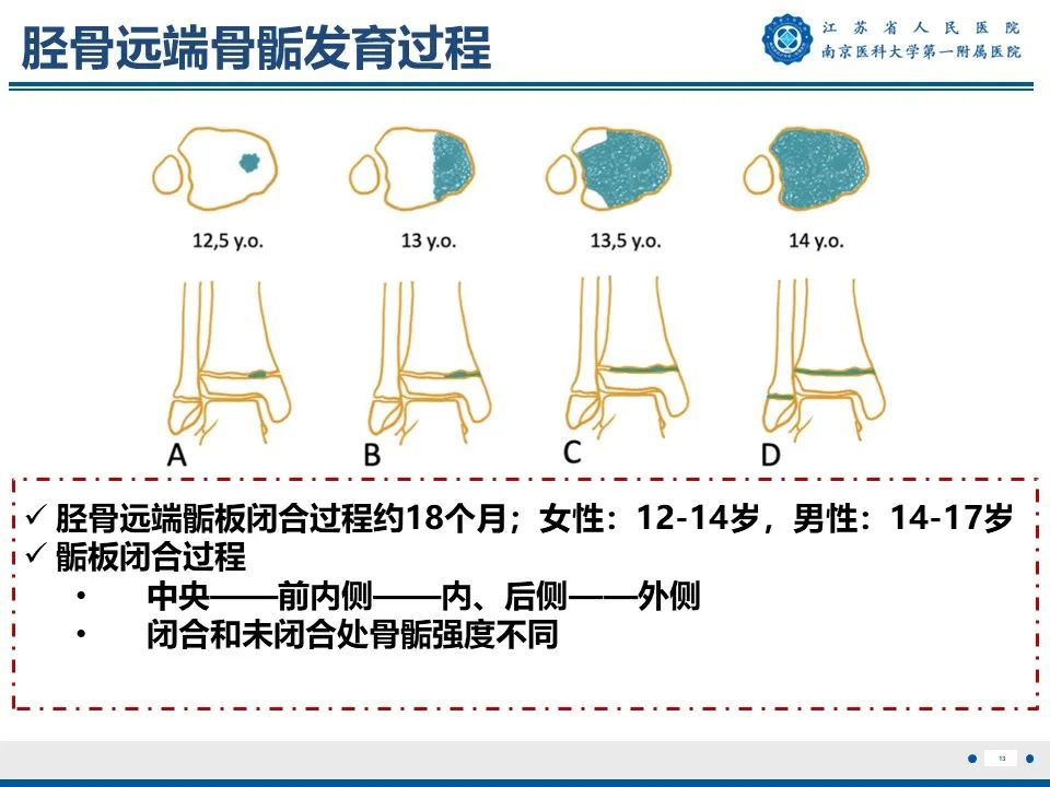 影像PPT - 【PPT】Tillaux骨折-14