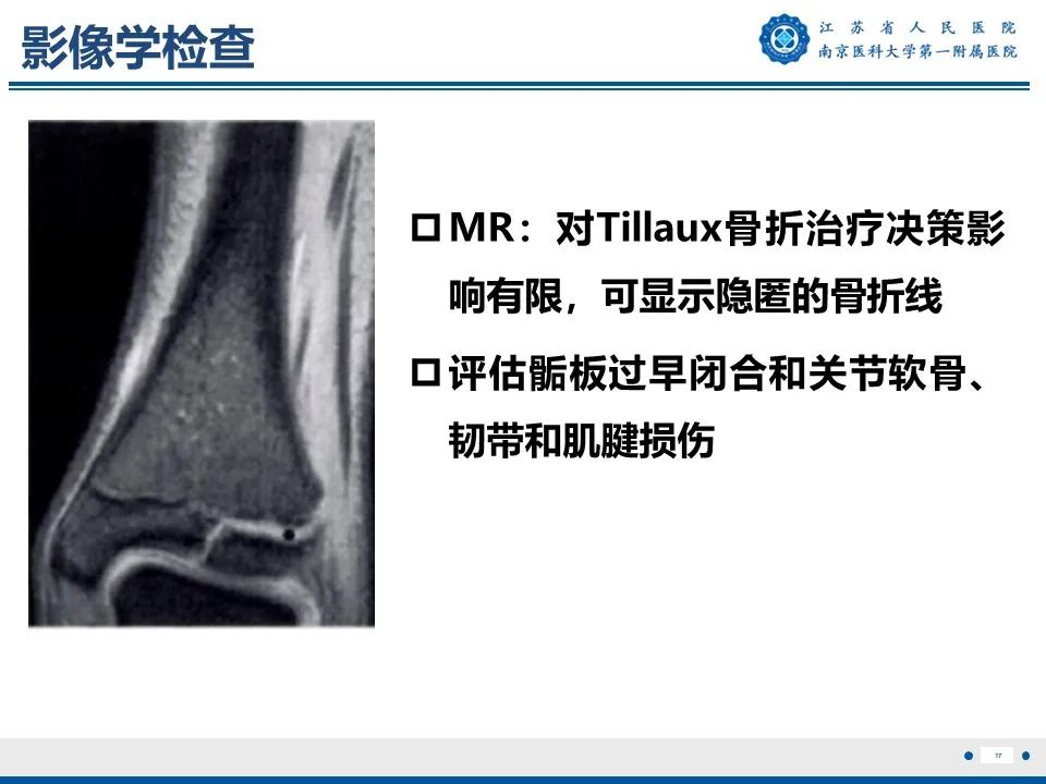 影像PPT - 【PPT】Tillaux骨折-18