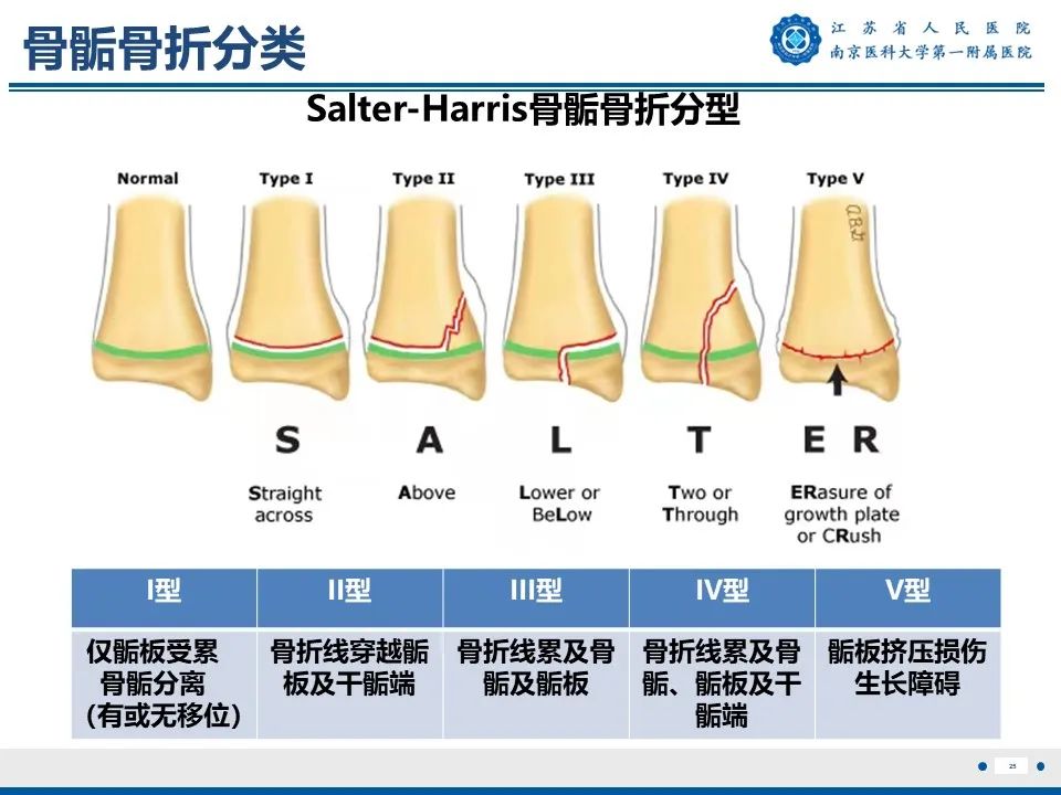 影像PPT - 【PPT】Tillaux骨折-26