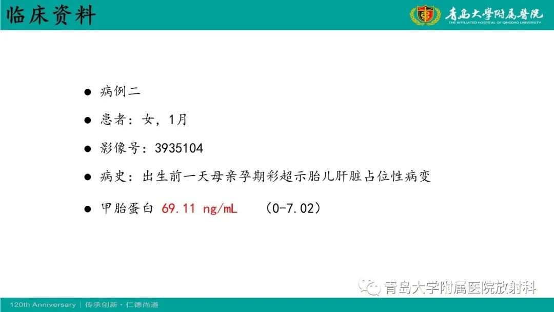 影像PPT - 【病例】婴儿型肝血管内皮细胞瘤2例CT影像-11