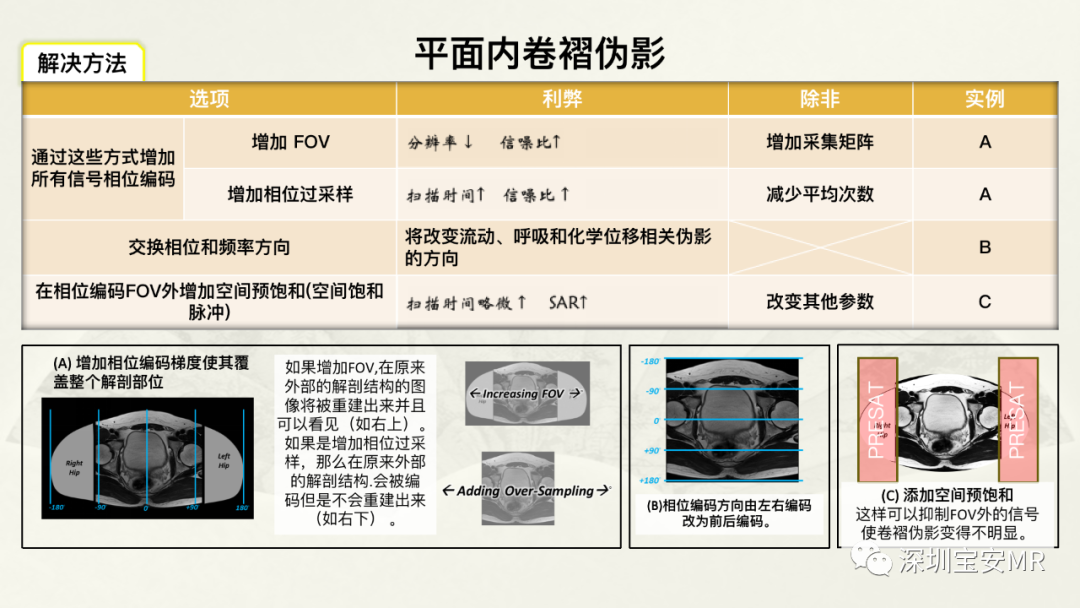 影像PPT - 【PPT】常见的MRI伪影和应对策略-5