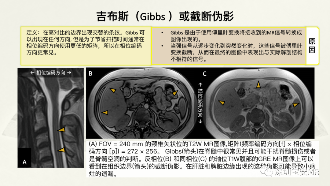 影像PPT - 【PPT】常见的MRI伪影和应对策略-9