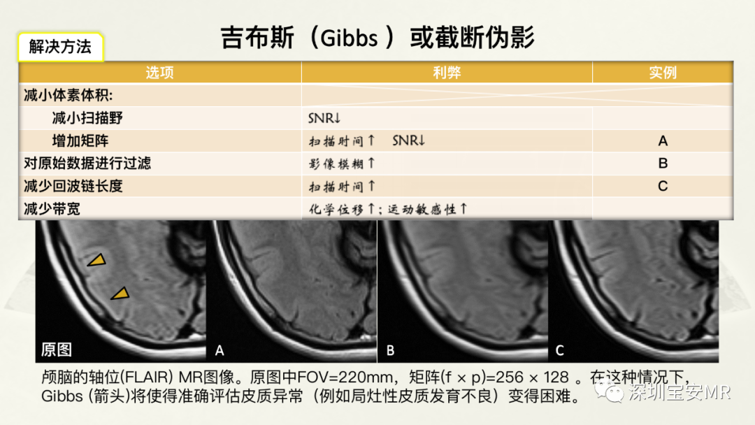 影像PPT - 【PPT】常见的MRI伪影和应对策略-10