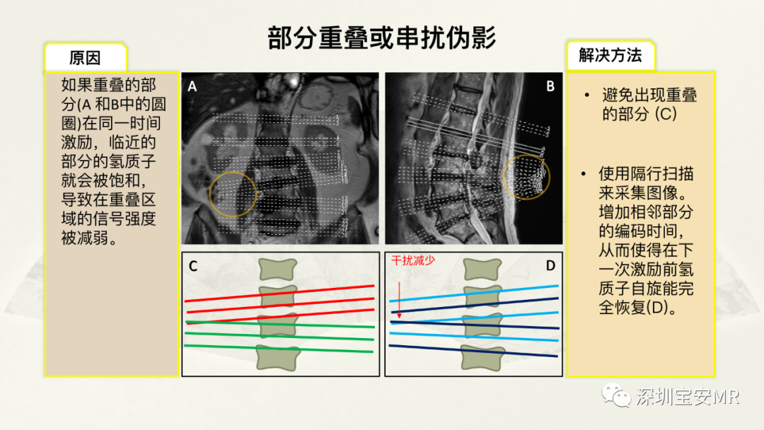 影像PPT - 【PPT】常见的MRI伪影和应对策略-12