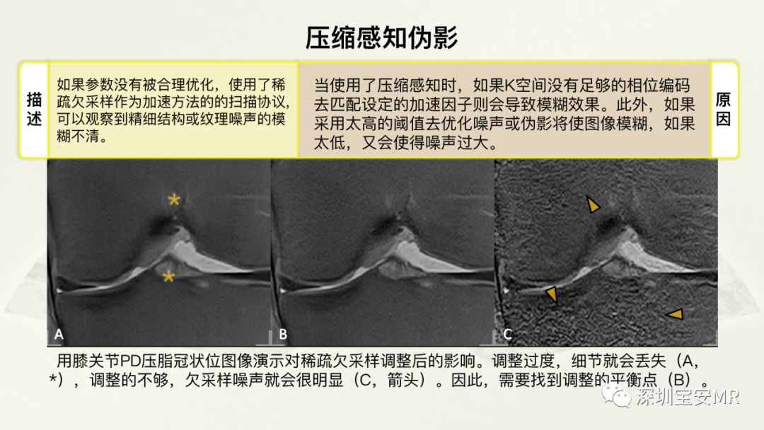 影像PPT - 【PPT】常见的MRI伪影和应对策略-16
