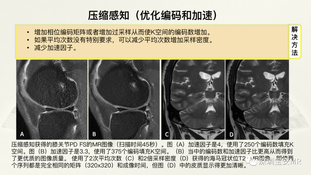影像PPT - 【PPT】常见的MRI伪影和应对策略-17