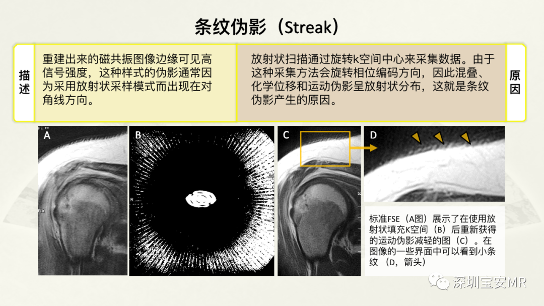 影像PPT - 【PPT】常见的MRI伪影和应对策略-18