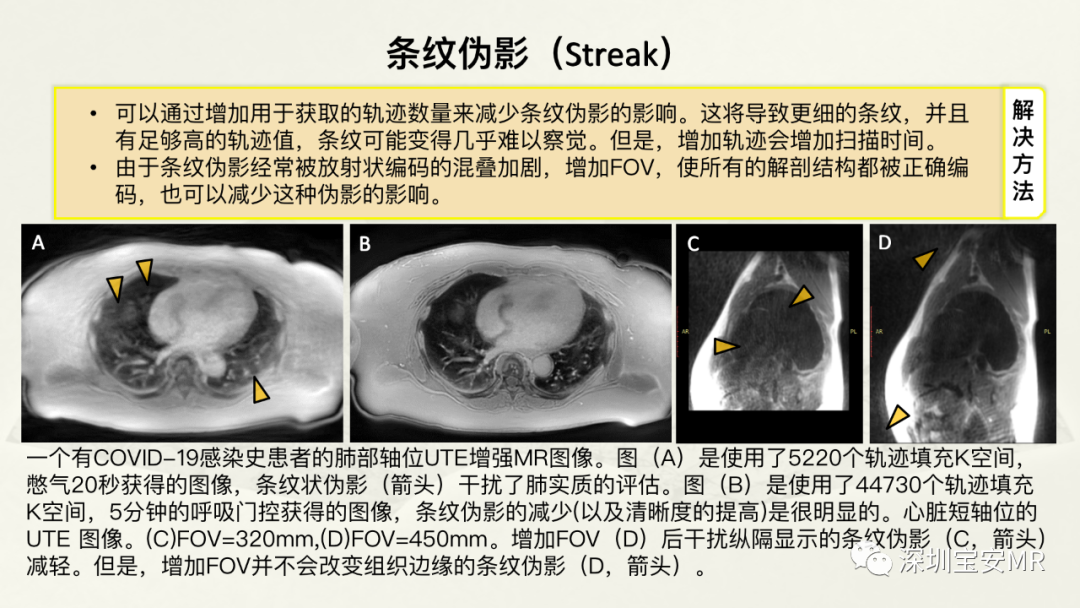 影像PPT - 【PPT】常见的MRI伪影和应对策略-19