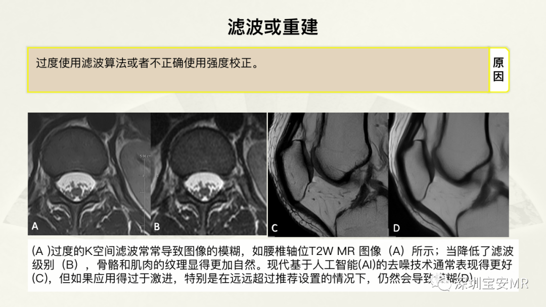 影像PPT - 【PPT】常见的MRI伪影和应对策略-20