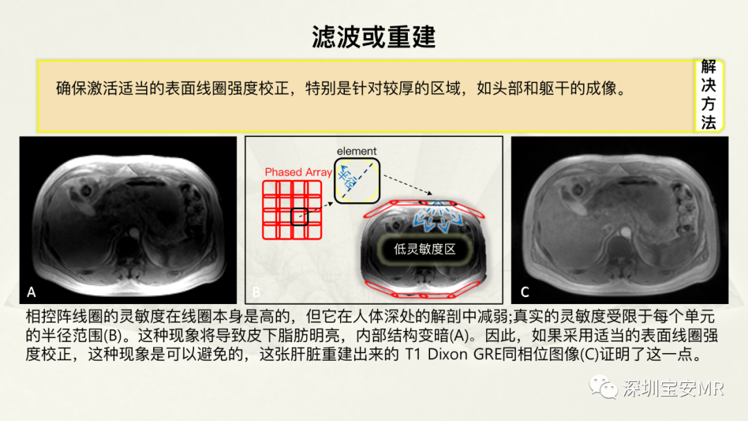 影像PPT - 【PPT】常见的MRI伪影和应对策略-22