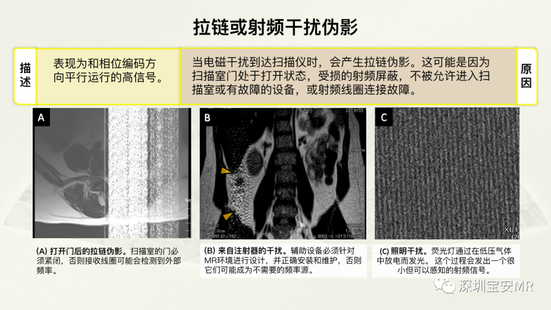 影像PPT - 【PPT】常见的MRI伪影和应对策略-23