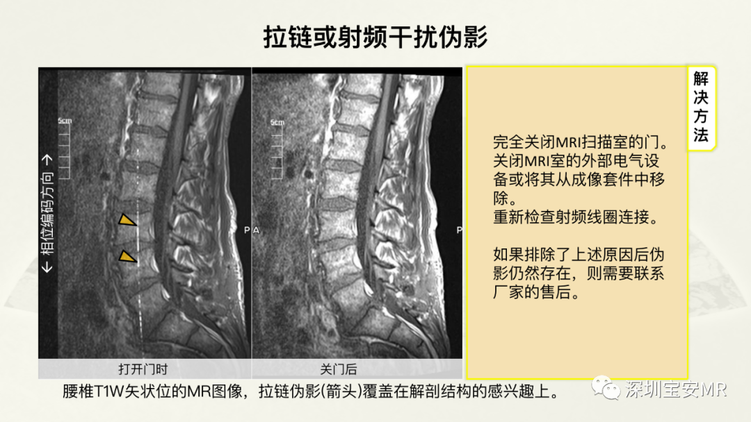 影像PPT - 【PPT】常见的MRI伪影和应对策略-24