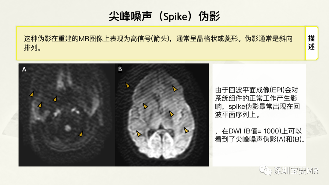 影像PPT - 【PPT】常见的MRI伪影和应对策略-25