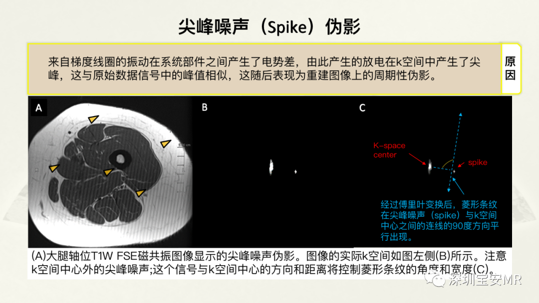 影像PPT - 【PPT】常见的MRI伪影和应对策略-26
