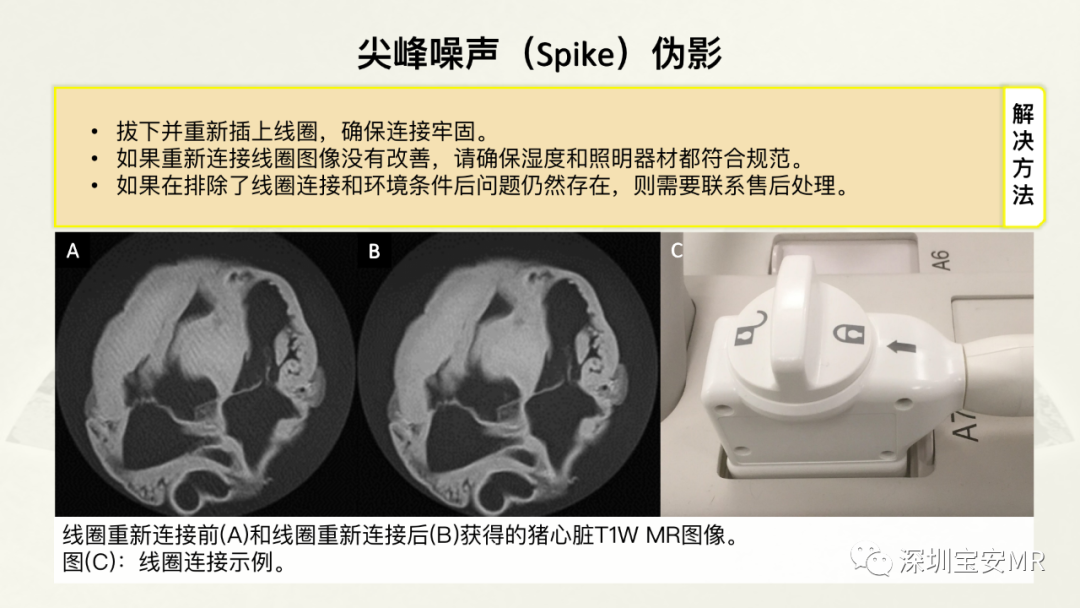 影像PPT - 【PPT】常见的MRI伪影和应对策略-27