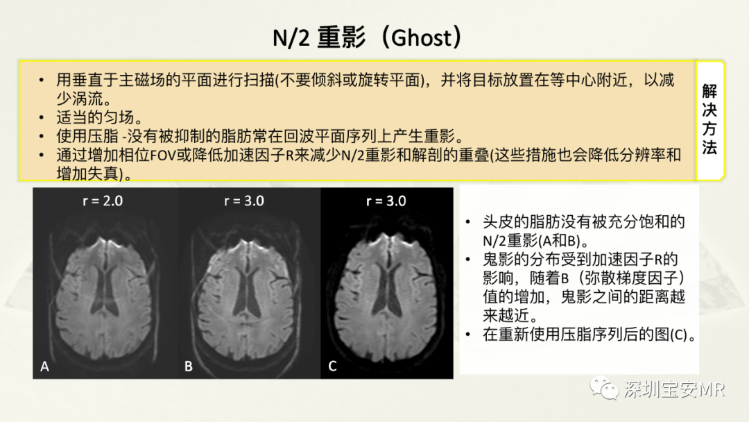 影像PPT - 【PPT】常见的MRI伪影和应对策略-30