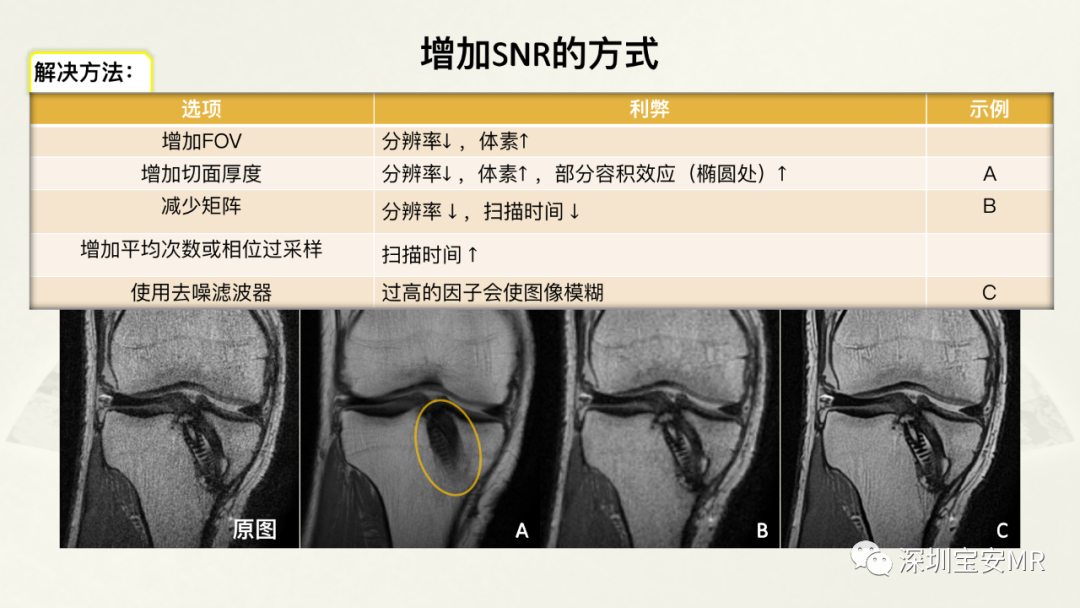 影像PPT - 【PPT】常见的MRI伪影和应对策略-34