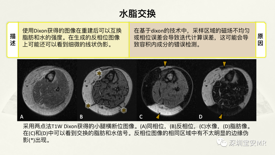 影像PPT - 【PPT】常见的MRI伪影和应对策略-35