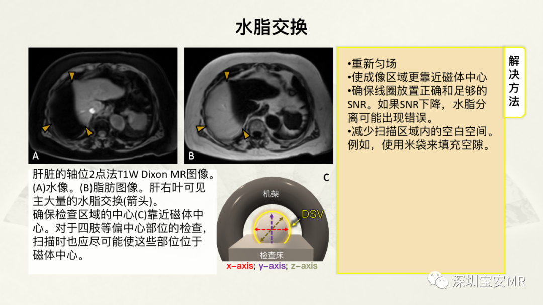 影像PPT - 【PPT】常见的MRI伪影和应对策略-36