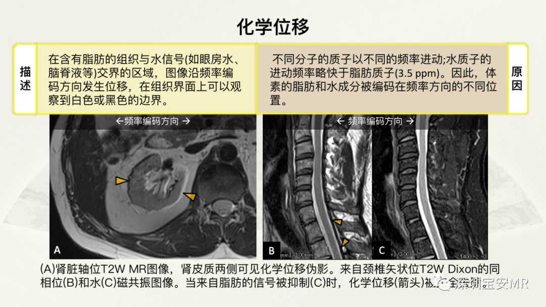 影像PPT - 【PPT】常见的MRI伪影和应对策略-37