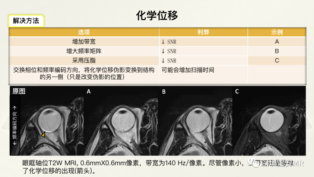 影像PPT - 【PPT】常见的MRI伪影和应对策略-38
