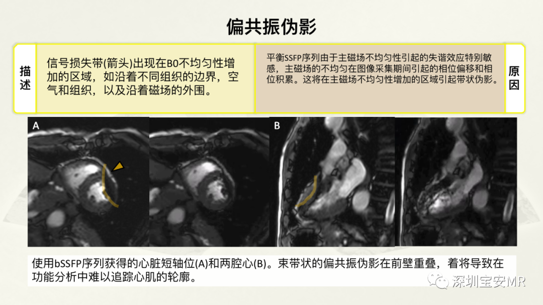 影像PPT - 【PPT】常见的MRI伪影和应对策略-40