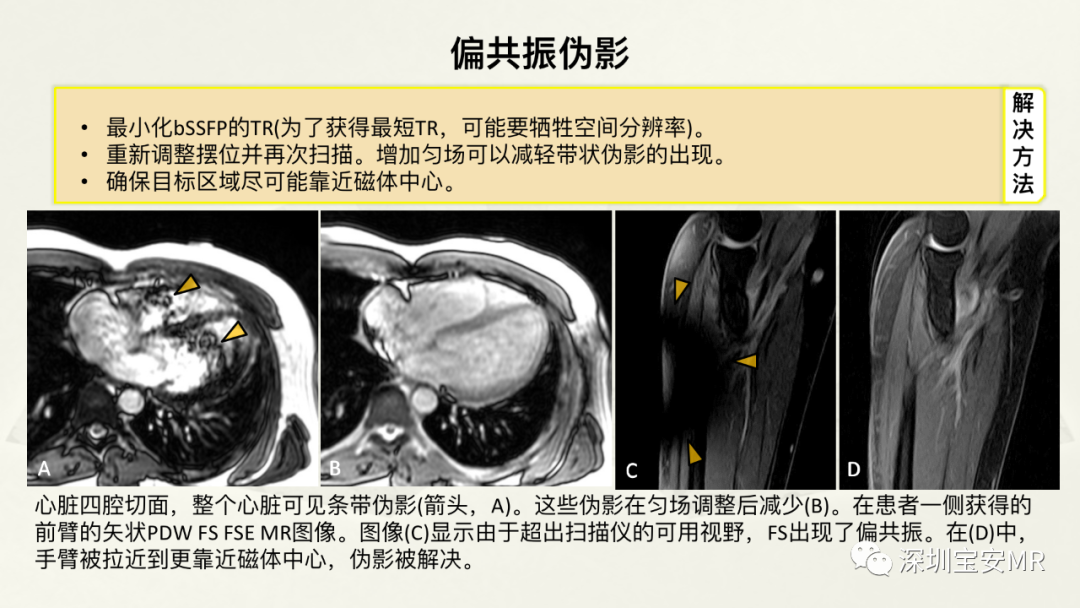 影像PPT - 【PPT】常见的MRI伪影和应对策略-41