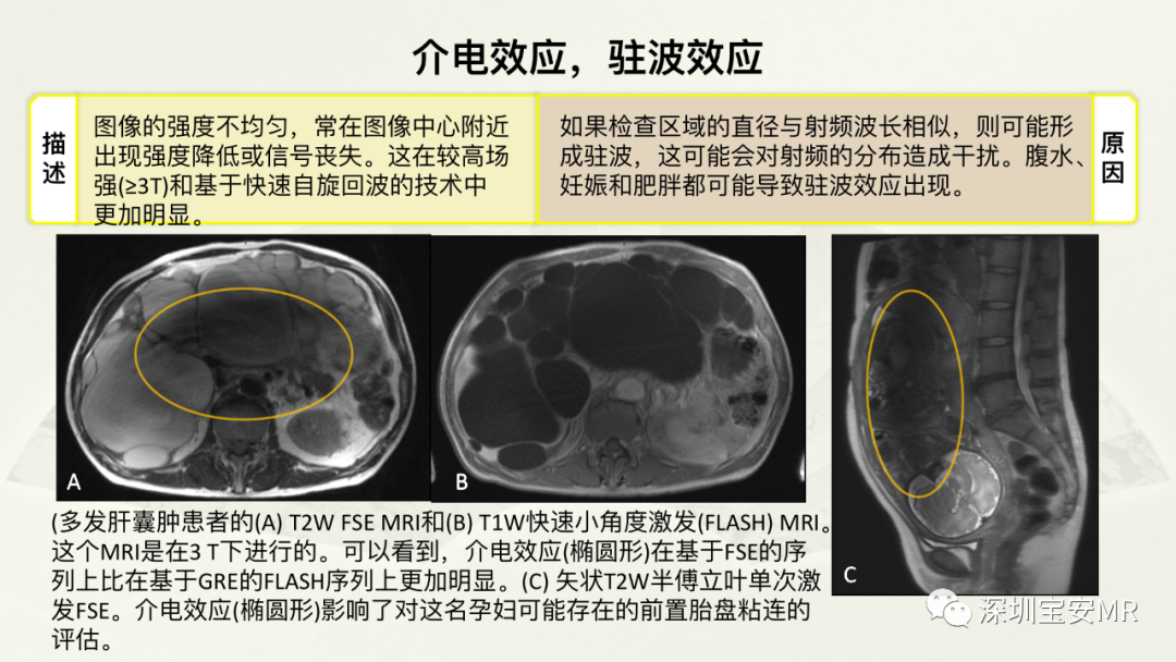影像PPT - 【PPT】常见的MRI伪影和应对策略-42