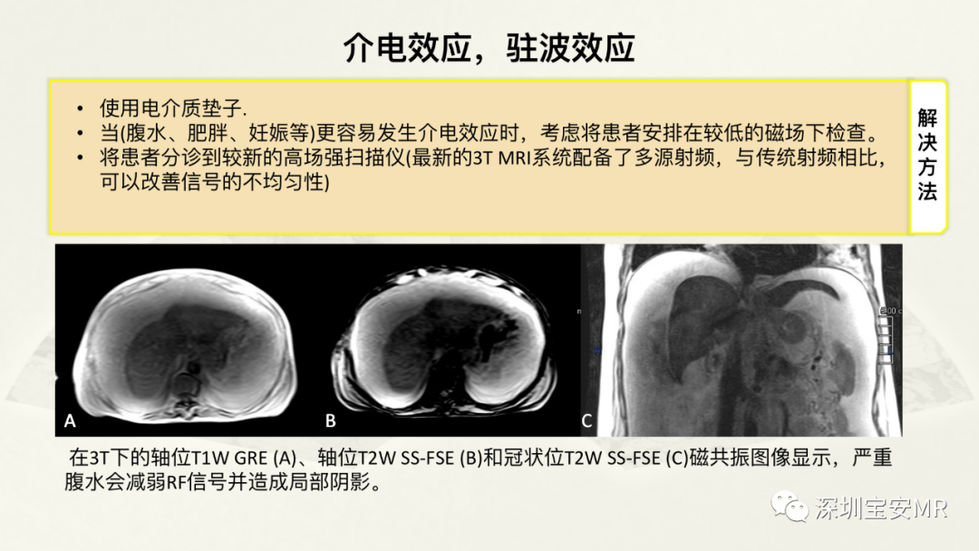 影像PPT - 【PPT】常见的MRI伪影和应对策略-43