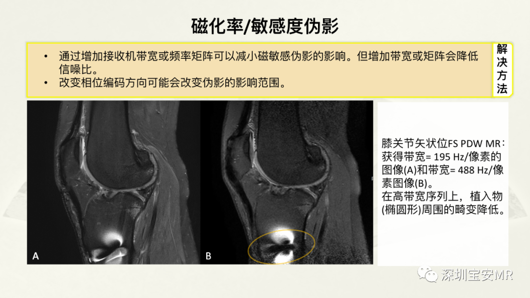 影像PPT - 【PPT】常见的MRI伪影和应对策略-45