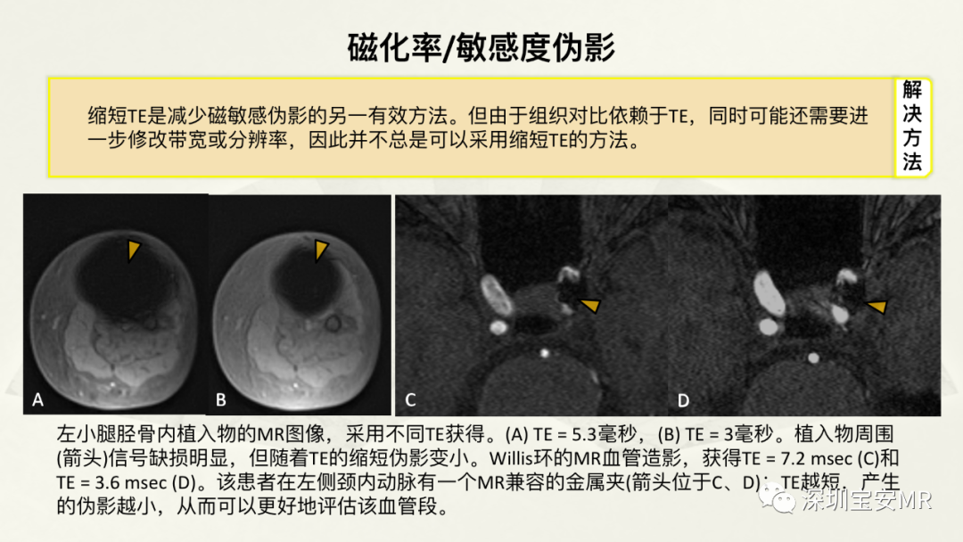 影像PPT - 【PPT】常见的MRI伪影和应对策略-46