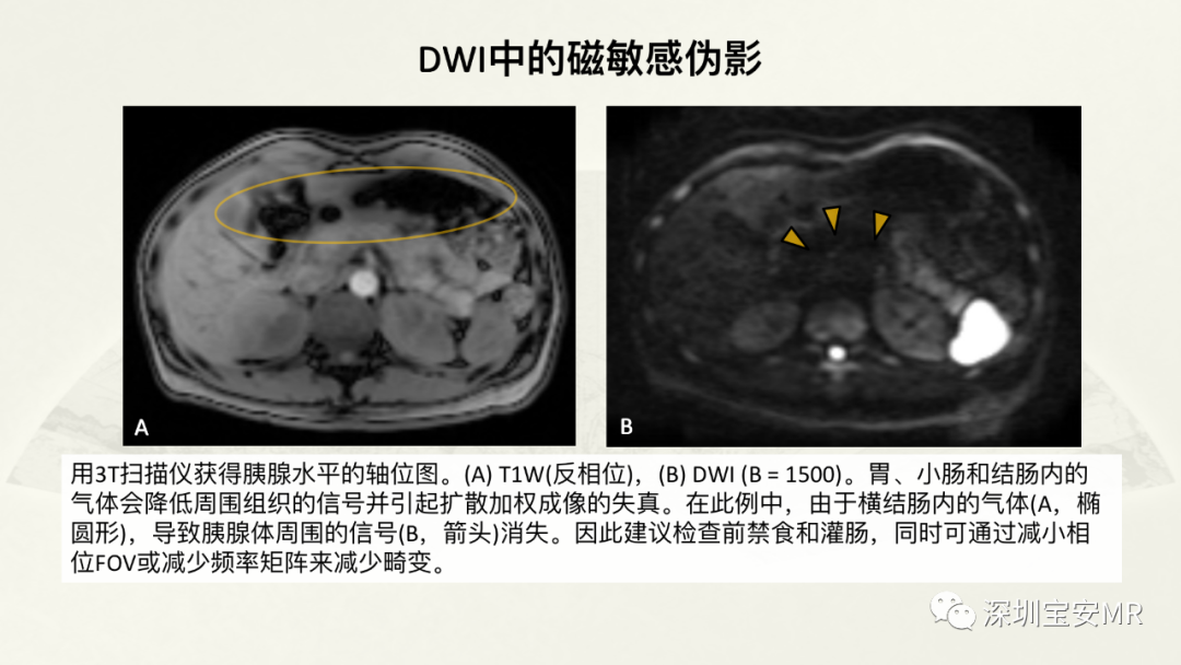 影像PPT - 【PPT】常见的MRI伪影和应对策略-48