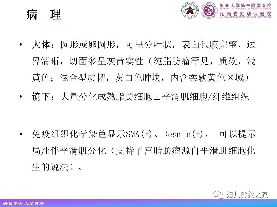 影像PPT - 【PPT】 子宫脂肪瘤-4