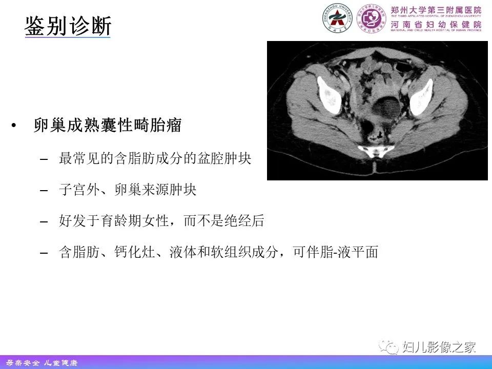 影像PPT - 【PPT】 子宫脂肪瘤-18