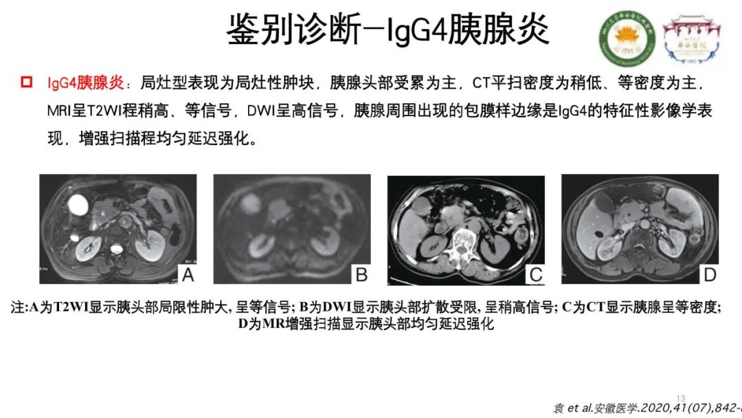 影像PPT - 【病例】胰腺脂肪替代1例CT影像-13