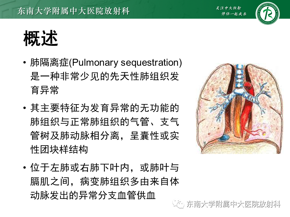 影像PPT - 【PPT】肺隔离症-5