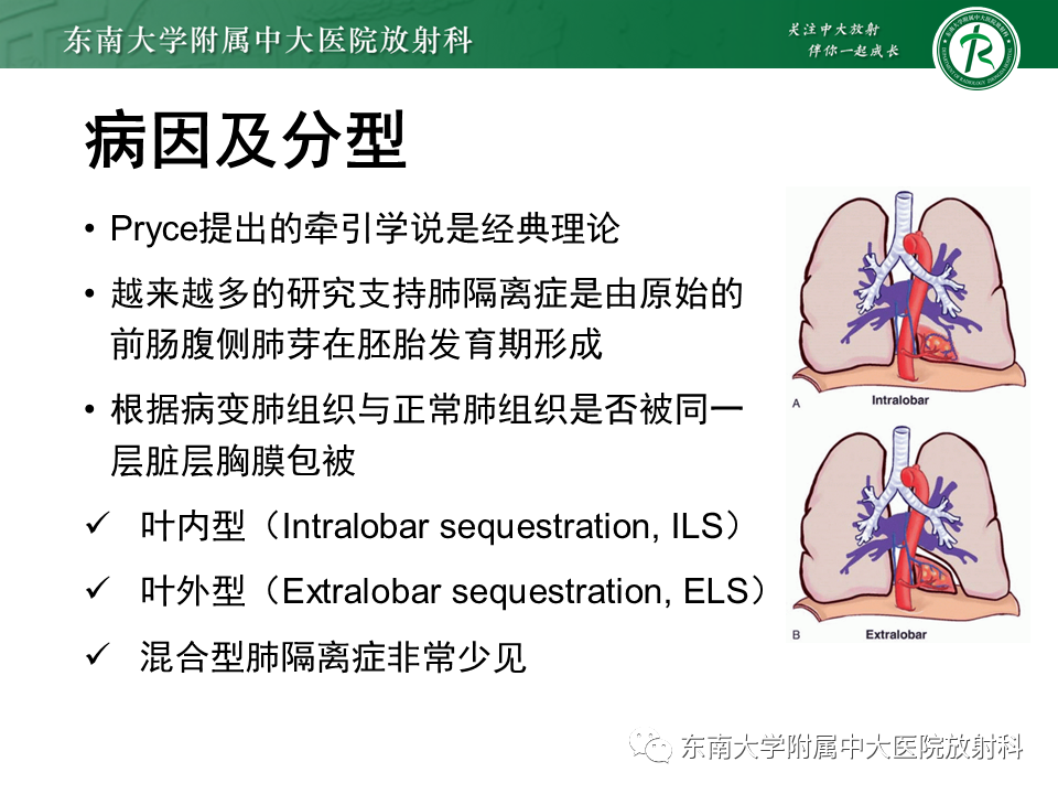 影像PPT - 【PPT】肺隔离症-6