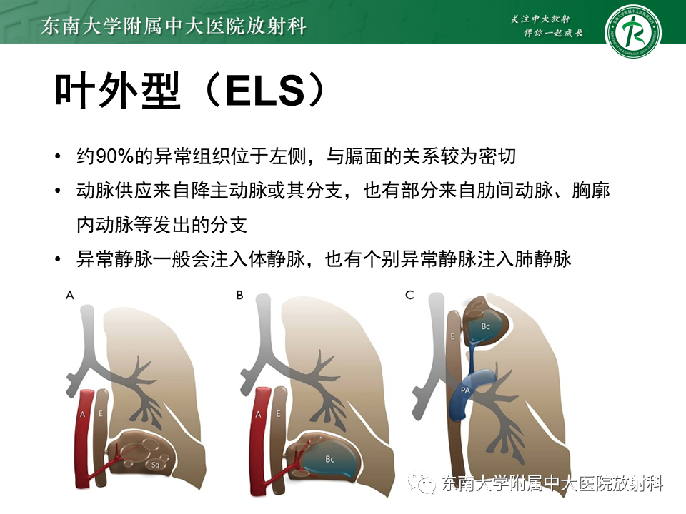 影像PPT - 【PPT】肺隔离症-8