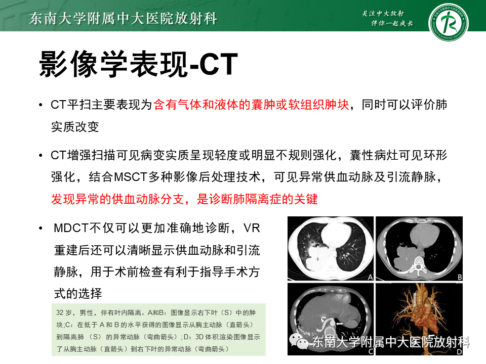 影像PPT - 【PPT】肺隔离症-11