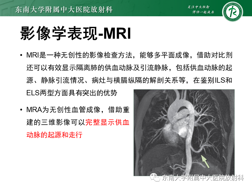影像PPT - 【PPT】肺隔离症-12
