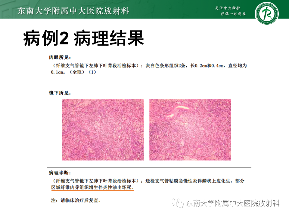 影像PPT - 【PPT】肺隔离症-17