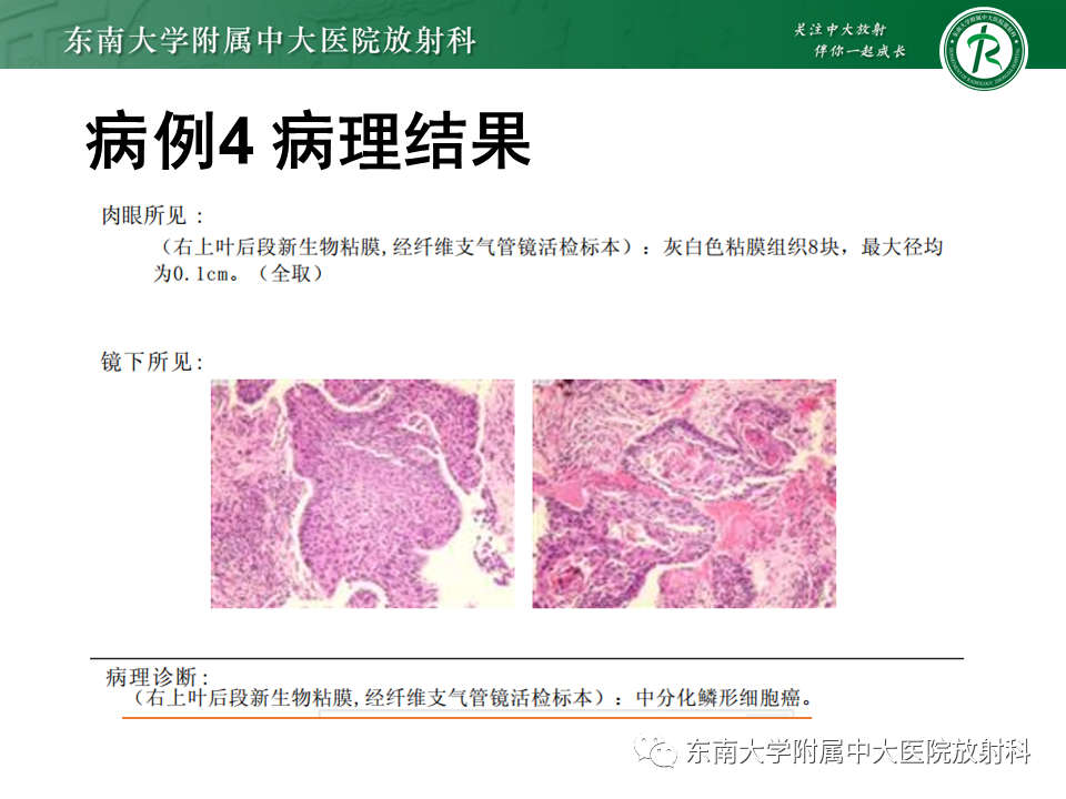 影像PPT - 【PPT】肺隔离症-27