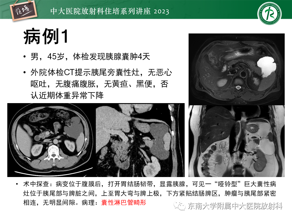 影像PPT - 【PPT】腹膜后原发囊性病变影像诊断思路-2