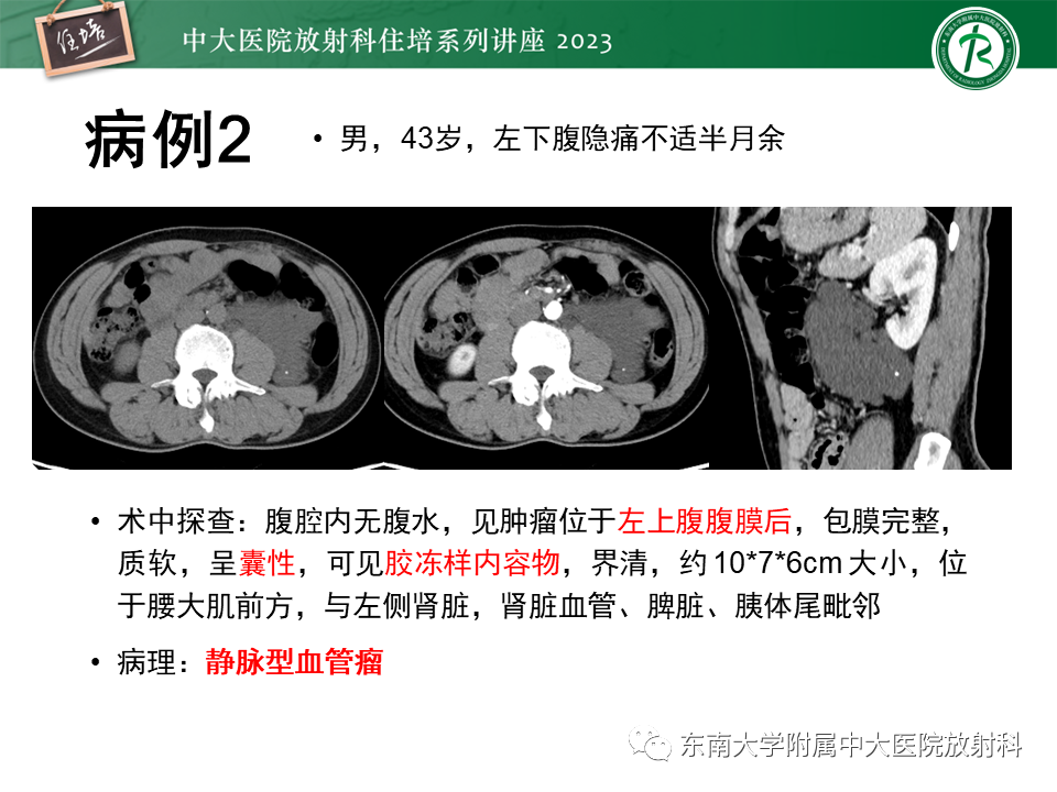 影像PPT - 【PPT】腹膜后原发囊性病变影像诊断思路-3