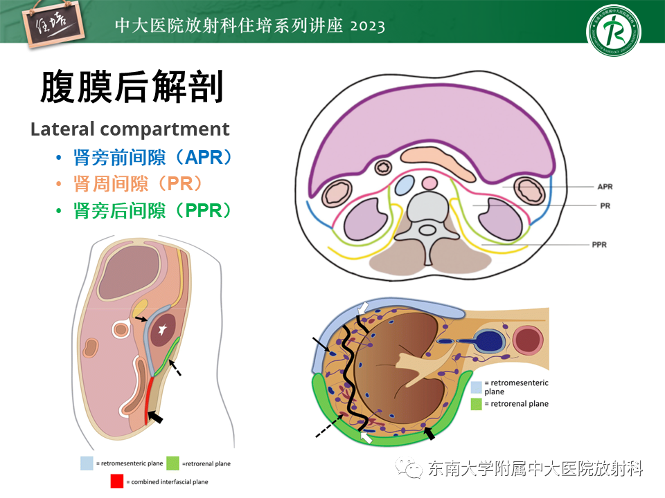 影像PPT - 【PPT】腹膜后原发囊性病变影像诊断思路-7