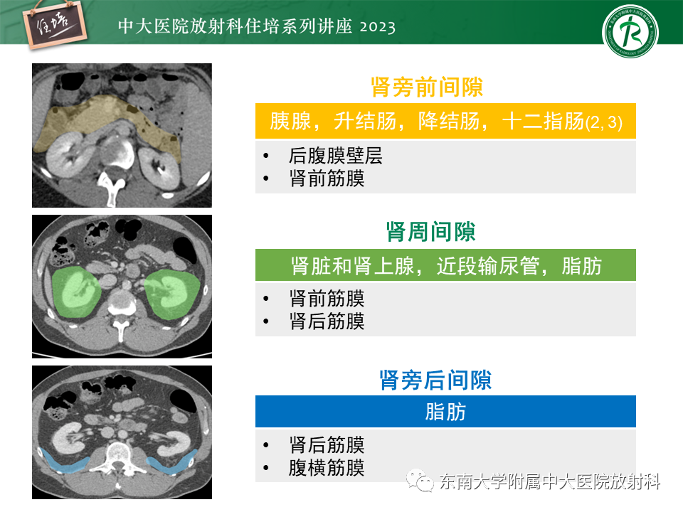 影像PPT - 【PPT】腹膜后原发囊性病变影像诊断思路-8