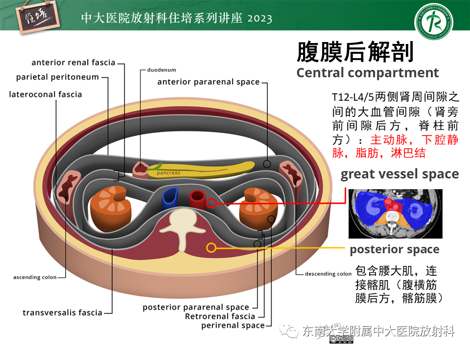 影像PPT - 【PPT】腹膜后原发囊性病变影像诊断思路-9
