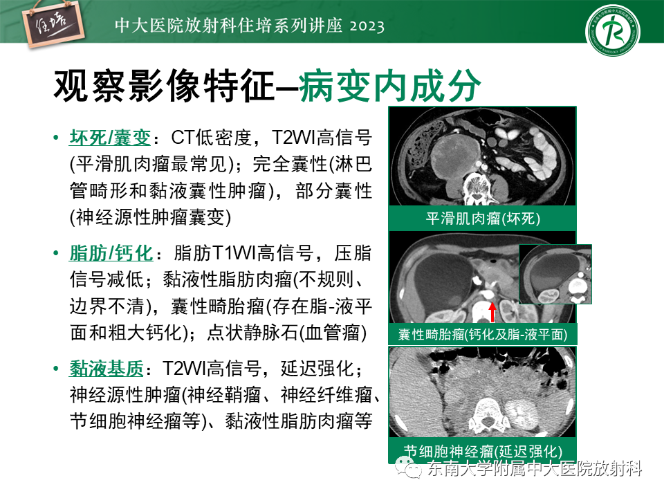 影像PPT - 【PPT】腹膜后原发囊性病变影像诊断思路-17