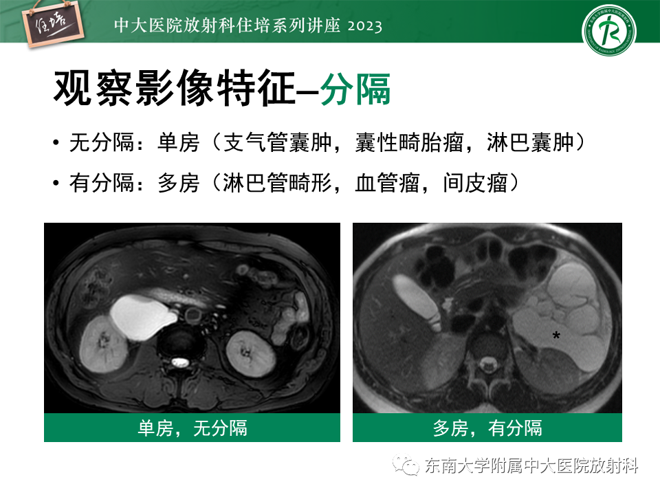 影像PPT - 【PPT】腹膜后原发囊性病变影像诊断思路-18