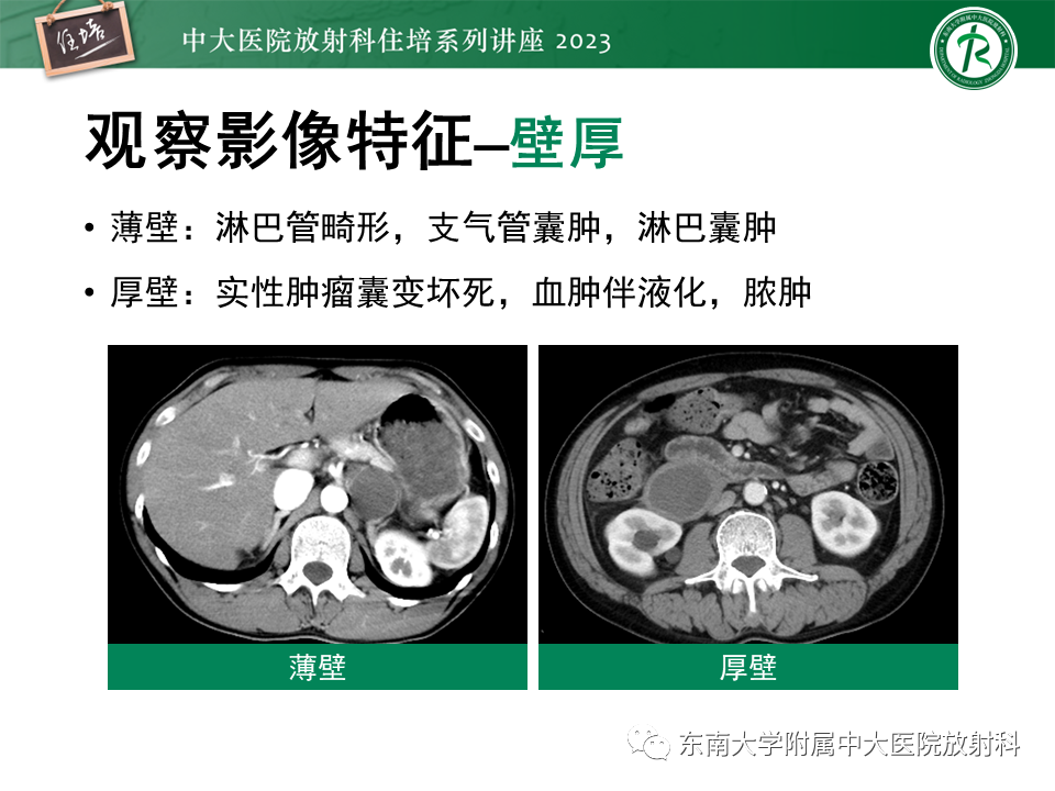影像PPT - 【PPT】腹膜后原发囊性病变影像诊断思路-19